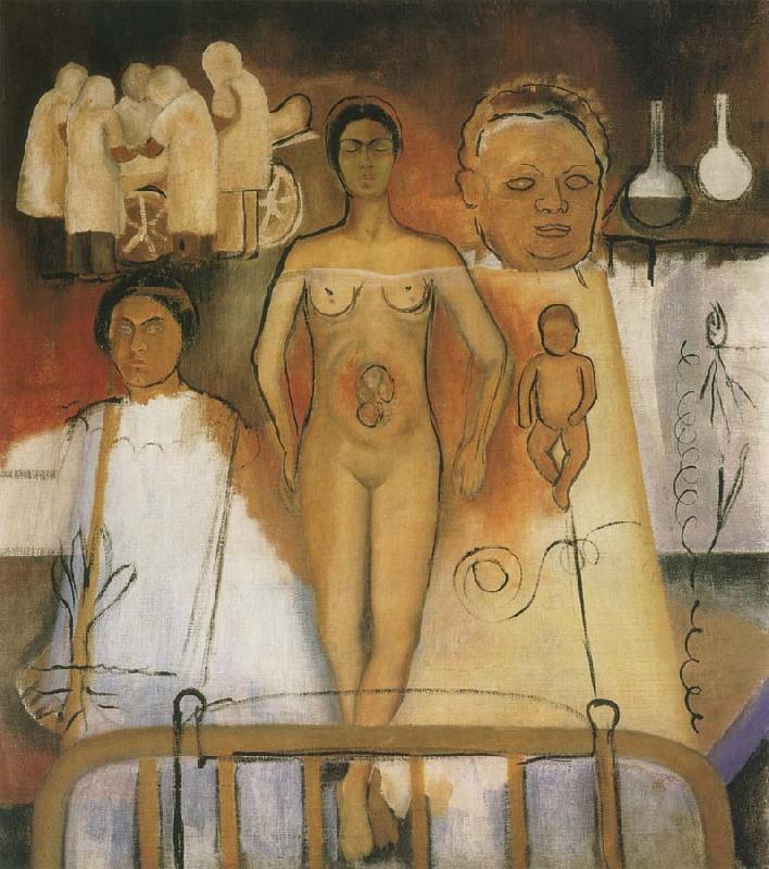 Frida Kahlo Kahlo and Caesarean operation oil painting image